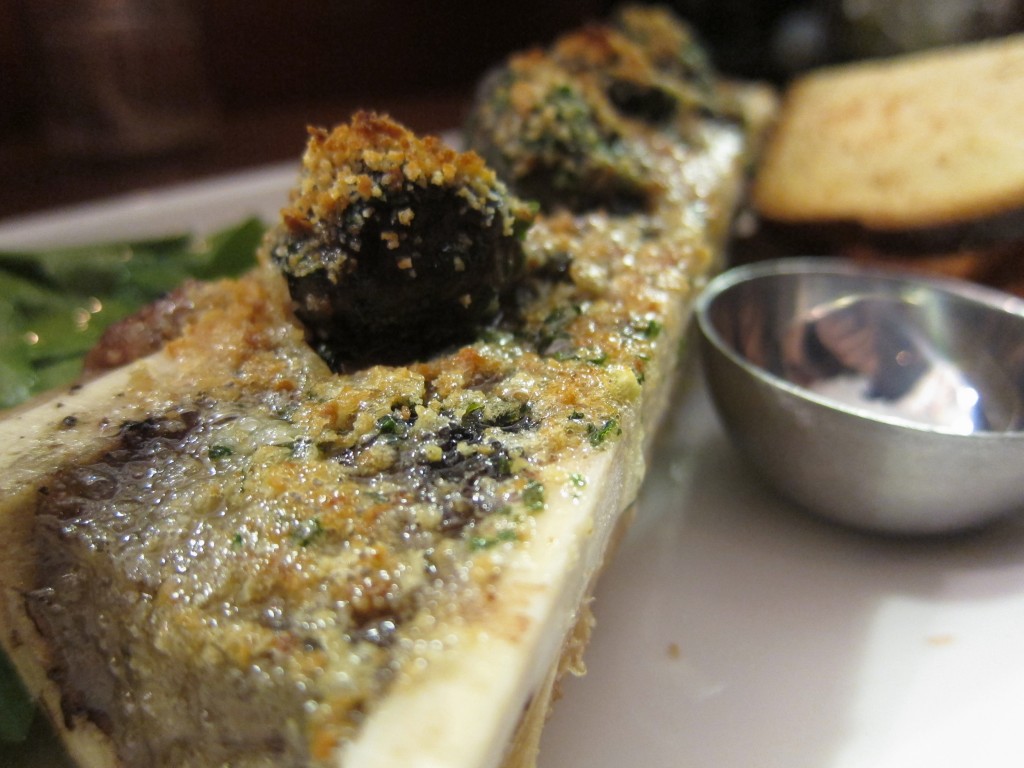 Bone Marrow Calgary